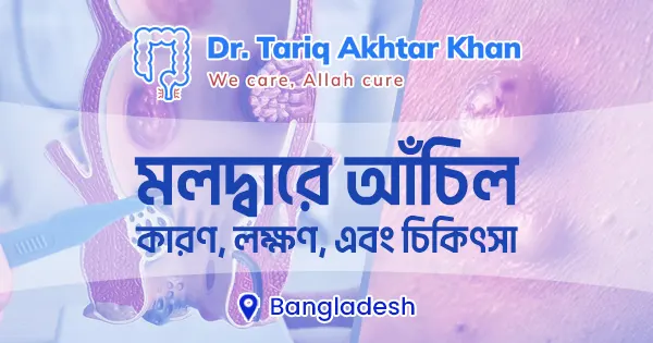 মলদ্বারে আঁচিল: কারণ, লক্ষণ, এবং চিকিৎসা
