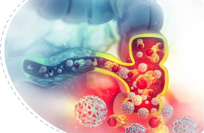 Colon Cancer Surgery Cost