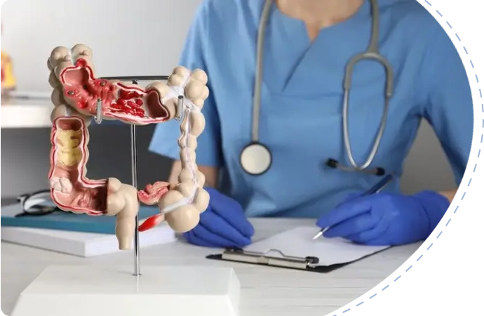 Colon Cancer symptoms