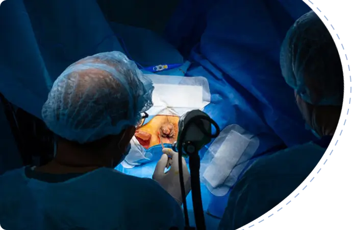 Dyssynergic defecation bowel disorder
