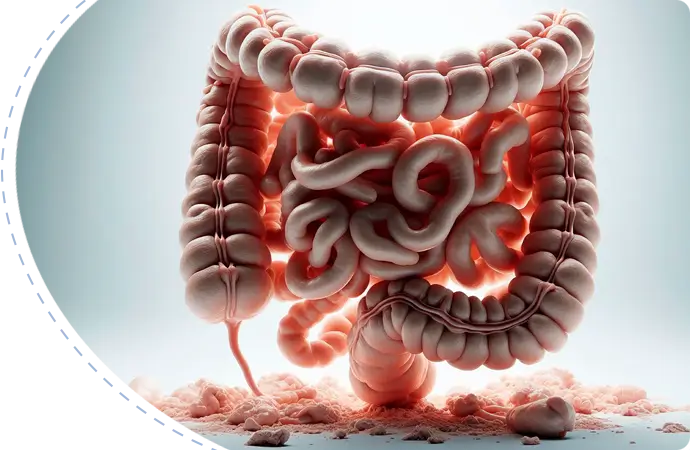 Dyssynergic Defecation Treatment in Bangladesh