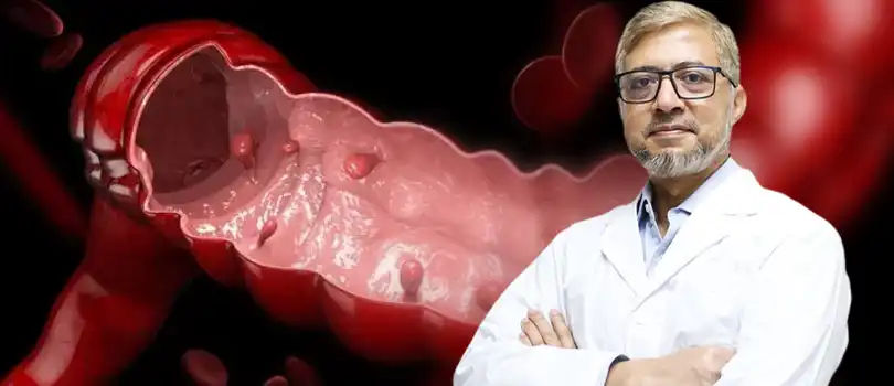 An expert colorectal polyps surgeon Dr. Tariq Akhtar Khan