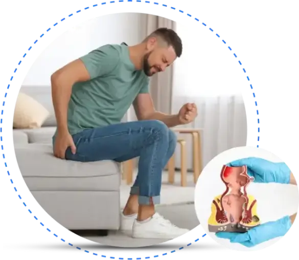 Best Piles Doctor and Colorectal Surgeon in Bangladesh