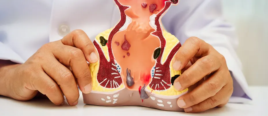 Human Papillomavirus (HPV)