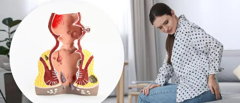 Itching and pain in anus