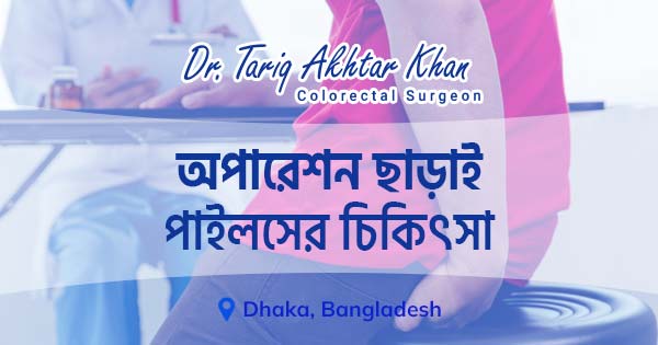অপারেশন ছাড়াই পাইলসের চিকিৎসা