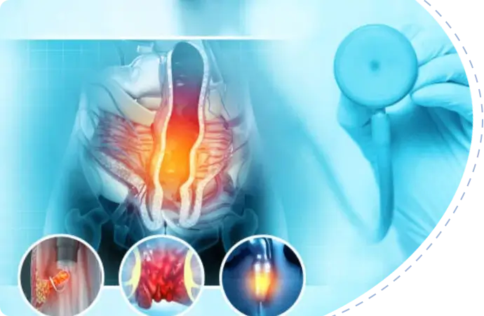 Piles operation cost in Bangladesh