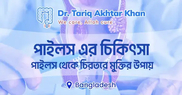 পাইলস এর চিকিৎসা; পাইলস থেকে চিরতরে মুক্তির উপায়