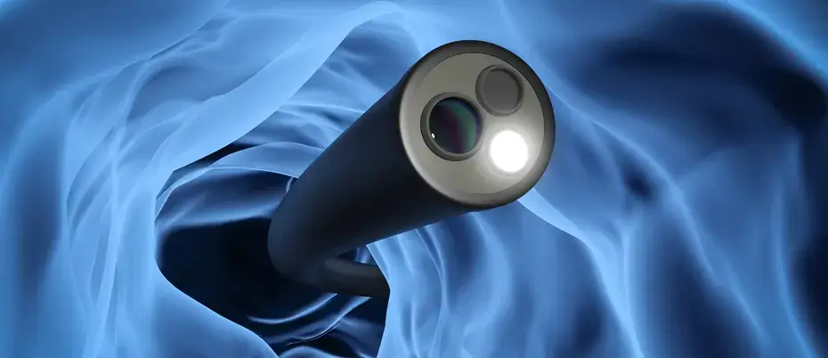 Pros & cons of laser treatment for piles