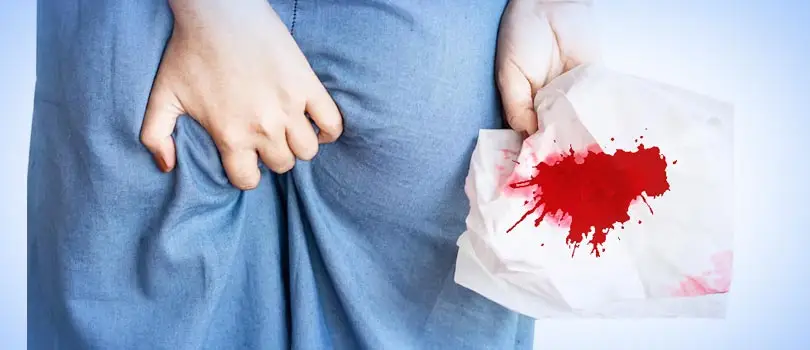 Rectal bleeding: Causes and treatment in Bangladesh