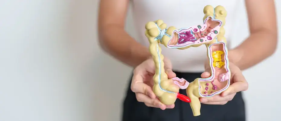 Rectal discharge Symptoms often come