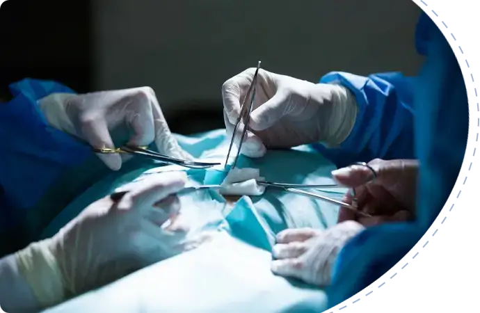 Rectovaginal fistula Symptoms 