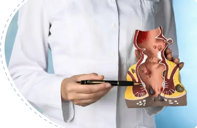 Rectovaginal fistula treatment