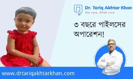 TransAnal Minimally Invasive Surgery
