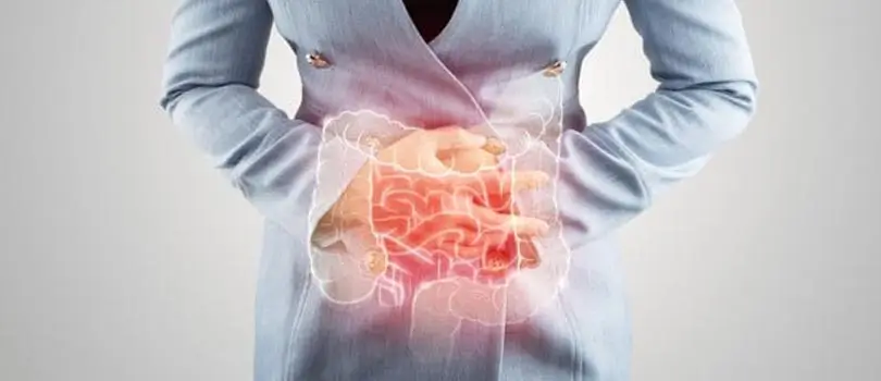 What is proctitis, and how is it treated?
