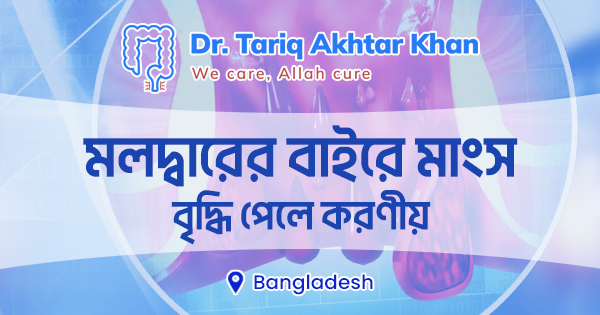 মলদ্বারের বাইরে মাংস বৃদ্ধি পেলে করণীয় 